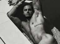 Baptiste Giabiconi, fier de ses vergetures aux fesses : "Elles font mon charme"