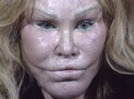 Jocelyn Wildenstein : La femme chat agresse son petit ami à coups de ciseaux