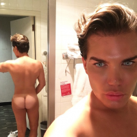 Rodrigo Alves : Nouvelle opération pour le Ken humain, quand sa peau se nécrose