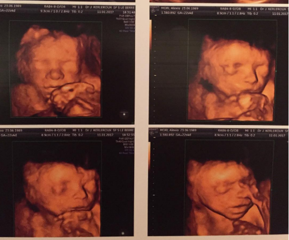 Alexia Mori dévoile le visage de son futur bébé. Janvier 2017.