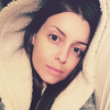 Alexia Mori juste après son opération du 24 mars 2016, avant les gonflements, sur Instagram.