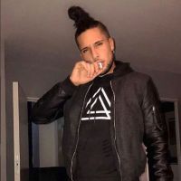 Eddy (Secret Story) s'offre un nouveau nez : Les premières photos chocs !