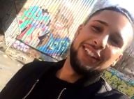 Eddy (Secret Story) : Après sa rhinoplastie, il dévoile son nouveau nez !