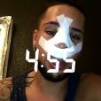 Eddy se dévoile après son opération de chirurgie, Snapchat, mars 2017