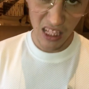 Justin Bieber porte le nouveau Grillz, qu'il s'est offert pour la modique somme de 13 000 euros - Photo publiée sur Instagram le 28 avril 2017