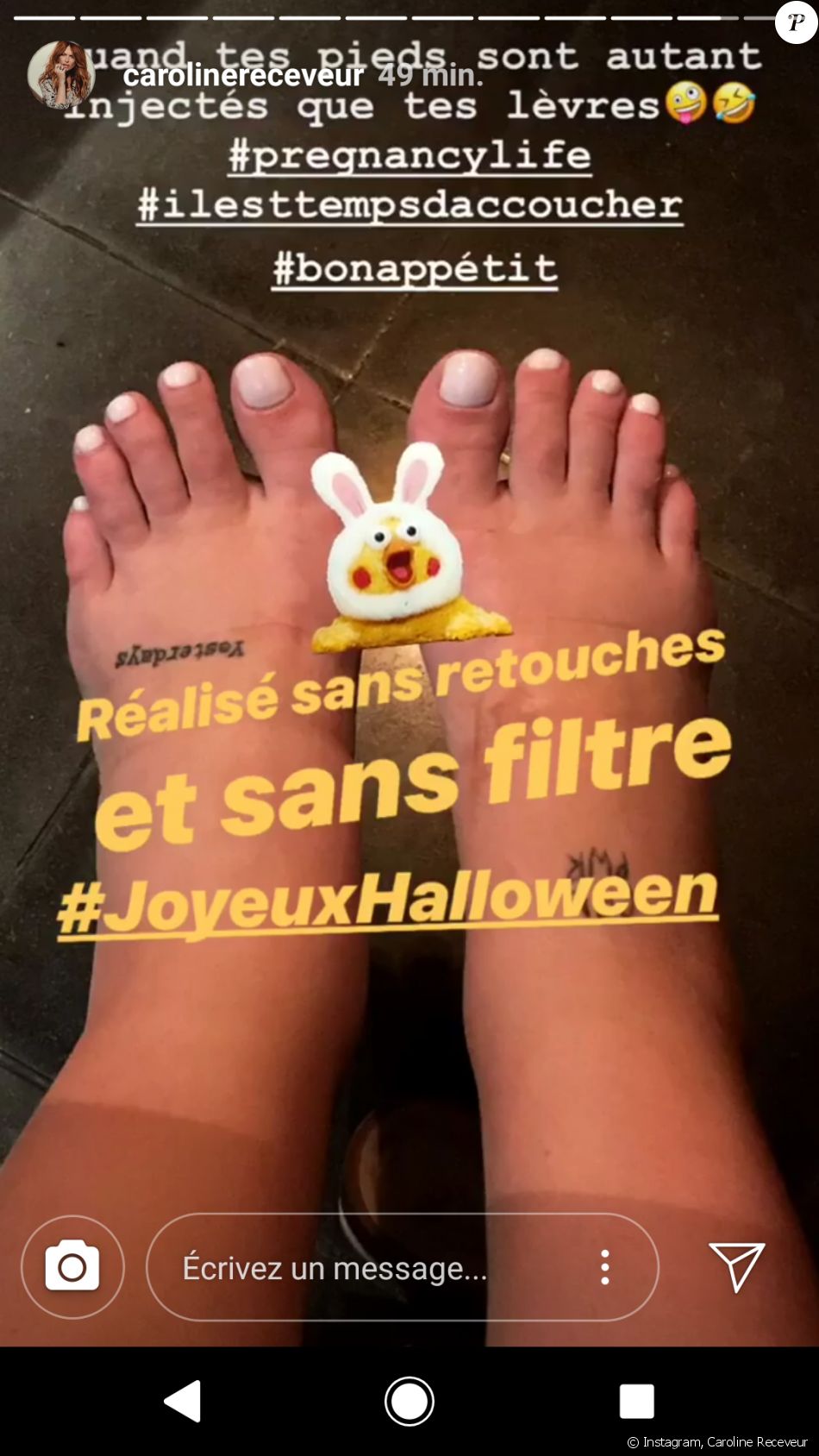 Caroline Receveur Devoile Ses Pieds Gonfles Du A Sa Grossesse Instagram 5 Juillet 18 Purepeople