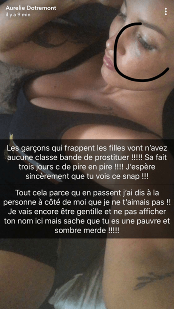Aurélie Dotremont s'est fait brutalement attaquée - Snapchat, 12 juillet 2018