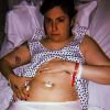 Lena Dunham s'est fait retirer les ovaires. Octobre 2018.