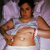 Lena Dunham : Nouvelle opération à l'ovaire, elle dévoile une photo