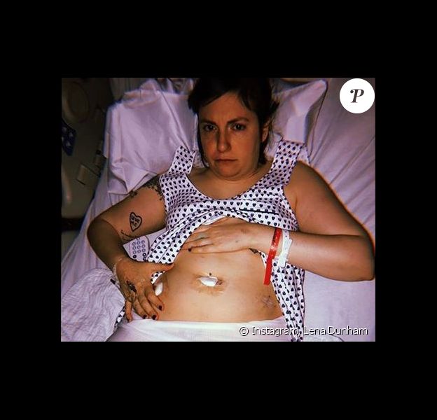 Lena Dunham s'est fait retirer les ovaires. Octobre 2018.