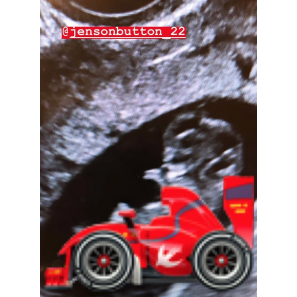 Jenson Button et sa fiancée Brittny Ward annoncent l'arrivée de leur premier enfant, le 18 janvier 2019.