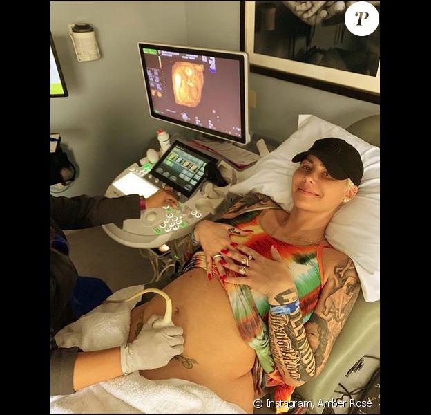 Amber Rose est enceinte. Elle attend son deuxième enfant, le premier avec son compagnon Alexander Edwards. Avril 2019.