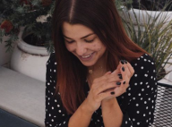 EnjoyPhoenix dévoile ses cicatrices sur son visage : "J'apprends à assumer..."