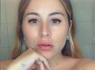 Anaïs Camizuli enceinte : Masque de grossesse, cernes... Elle montre tout !