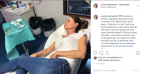 Carole Dechantre à l'hôpital pour un cancer de la peau, Instagram, 18 juin 2019