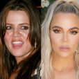 Khloé Kardashian méconnaissable : les moments forts de sa transformation