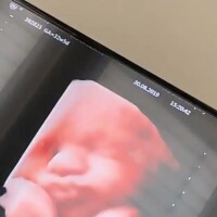 Nabilla enceinte : le visage de son bébé Milann, en vidéo, la fait craquer
