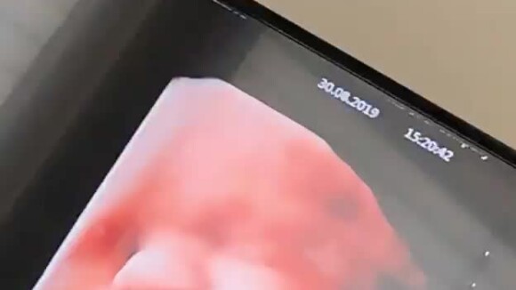Nabilla enceinte : le visage de son bébé Milann, en vidéo, la fait craquer