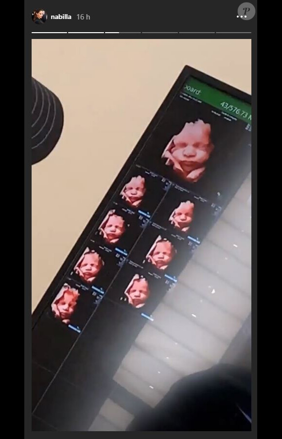 Nabilla enceinte : elle montre la tête de son bébé sur Instagram (Août 2019).
