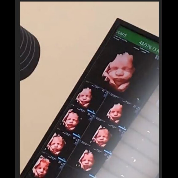 Nabilla enceinte : elle montre la tête de son bébé sur Instagram (Août 2019).