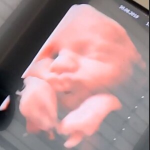 Nabilla enceinte : elle montre la tête de son bébé sur Instagram (Août 2019).