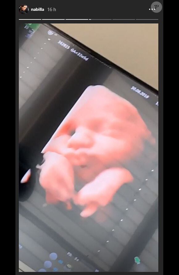 Nabilla enceinte : elle montre la tête de son bébé sur Instagram (Août 2019).