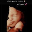 Nabilla enceinte : elle montre la tête de son bébé sur Instagram (Août 2019).