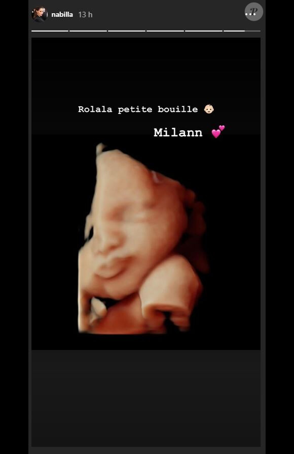 Nabilla enceinte : elle montre la tête de son bébé sur Instagram (Août 2019).