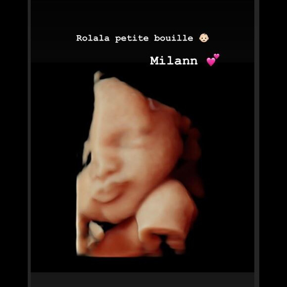 Nabilla enceinte : elle montre la tête de son bébé sur Instagram (Août 2019).