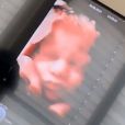 Nabilla enceinte : elle montre la tête de son bébé sur Instagram (Août 2019).