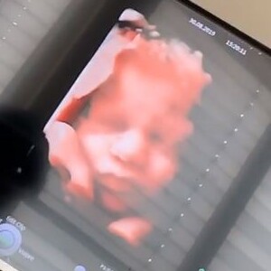 Nabilla enceinte : elle montre la tête de son bébé sur Instagram (Août 2019).