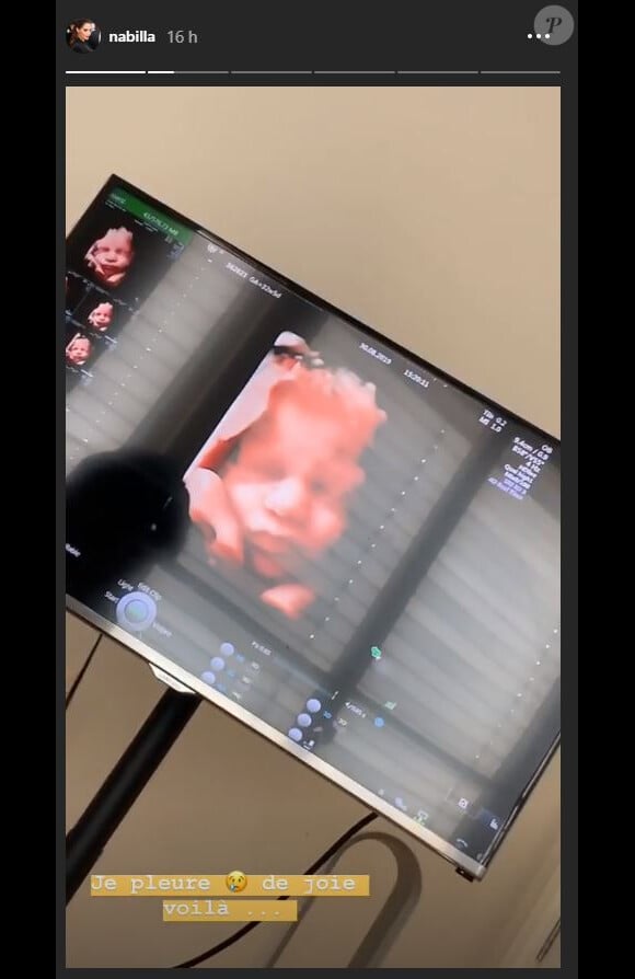 Nabilla enceinte : elle montre la tête de son bébé sur Instagram (Août 2019).