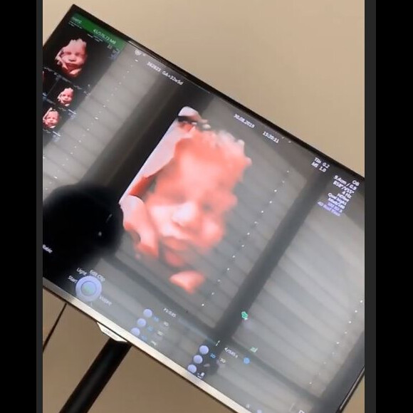 Nabilla enceinte : elle montre la tête de son bébé sur Instagram (Août 2019).