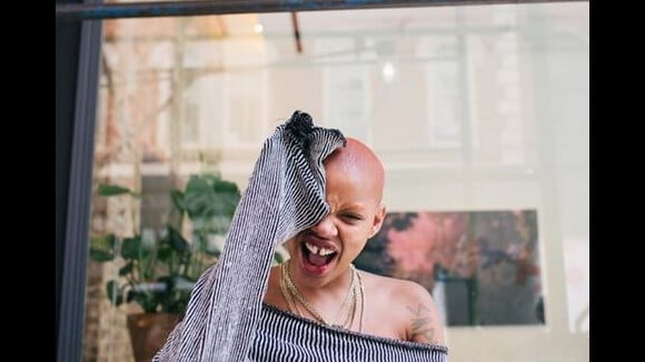 Slick Woods malade : la muse de Rihanna a un cancer