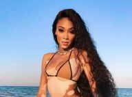 Winnie Harlow : Divine en bikini, la bombe atteinte de vitiligo embrase la Toile