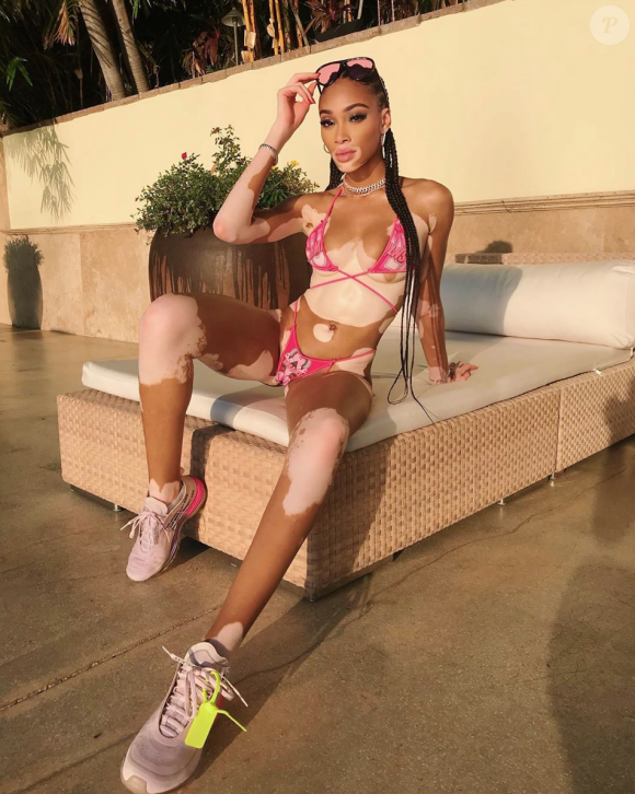 Winnie Harlow à Miami. Janvier 2020.
