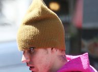 Justin Bieber atteint d'une maladie incurable : "Je ne devrais pas être en vie"