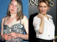 Renée Zellweger : Joufflue, amincie, tirée... Son évolution physique en images