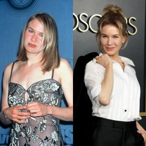 L'évolution physique de l'actrice Renée Zellweger. Ici aux MTV Movie Awards en 1997, puis au déjeuner des nominés aux Oscars à Los Angeles, le 27 janvier 2020.
