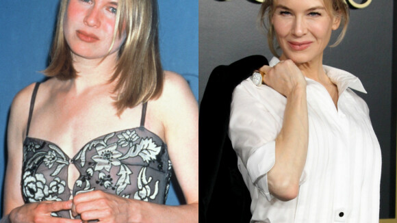 Renée Zellweger : Joufflue, amincie, tirée... Son évolution physique en images