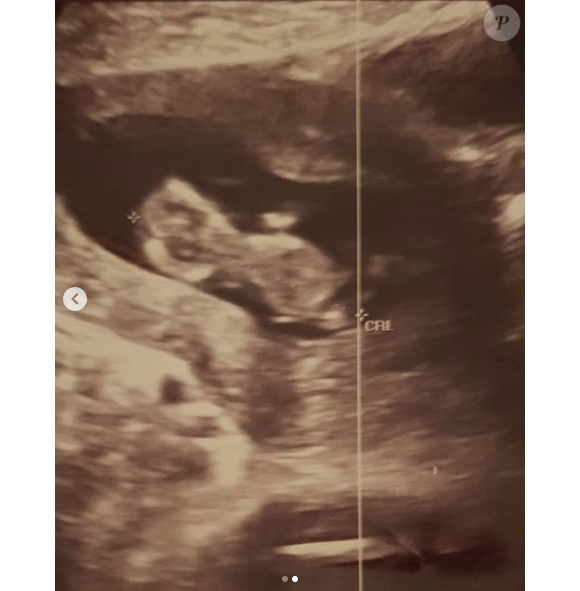 Marion Bartoli est enceinte de son premier enfant. Une annonce faite le 28 mai 2020.