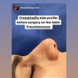 Mia Khalifa sur Instagram. La jeune influenceuse s'est fait refaire le nez le 23 juin 2020.