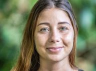 Charlotte (Koh-lanta) et la chirurgie esthétique : elle révèle son opération