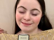 Ellie Goldstein : Gucci engage son premier mannequin handicapé
