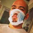 Moïse Santamaria avec un masque troué sur le visage, photo Instagram du 18 juillet 2020