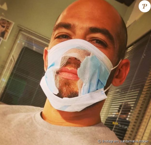 Moïse Santamaria avec un masque troué sur le visage, photo Instagram du 18 juillet 2020