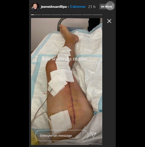 Jean-Edouard Lipa dévoile les coulisses de sa convalescence. Instagram. Le 28 septembre 2020.