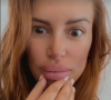Maeva Martinez (Secret Story) apparaît les lèvres très gonflées sur Instagram