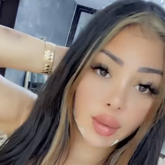 Maeva Ghennam est soupçonnée d'avoir eu recours à une nouvelle opération de chirurgie esthétique - Snapchat