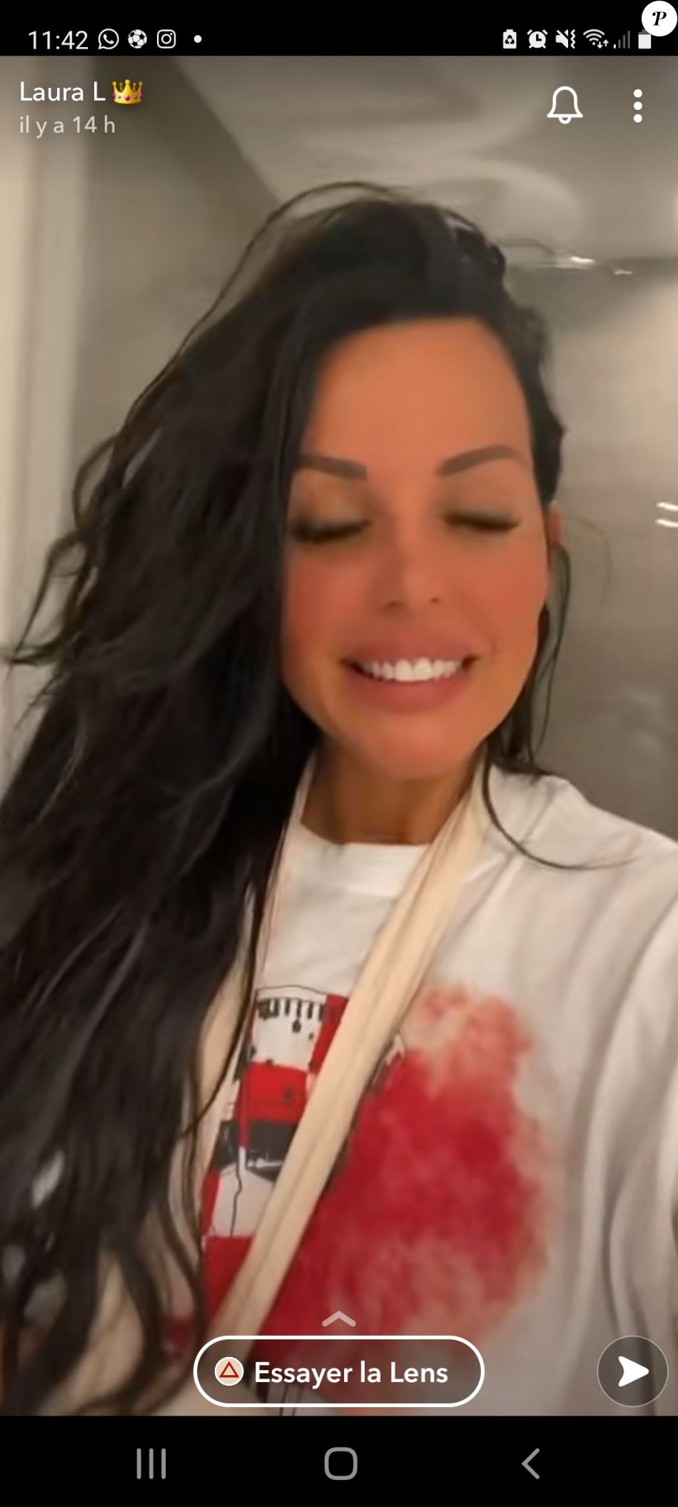 Laura Lempika blessée, elle partage sa mésaventure sur Snapchat, le 14 juillet 2021